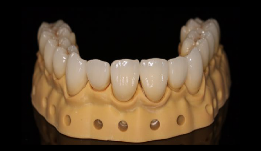 名匠全瓷（鋯）